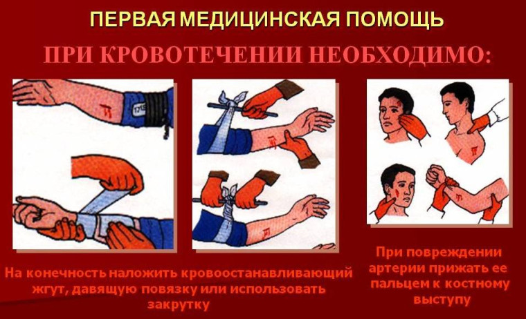 Видеоролики. Первая помощь при кровотечении.