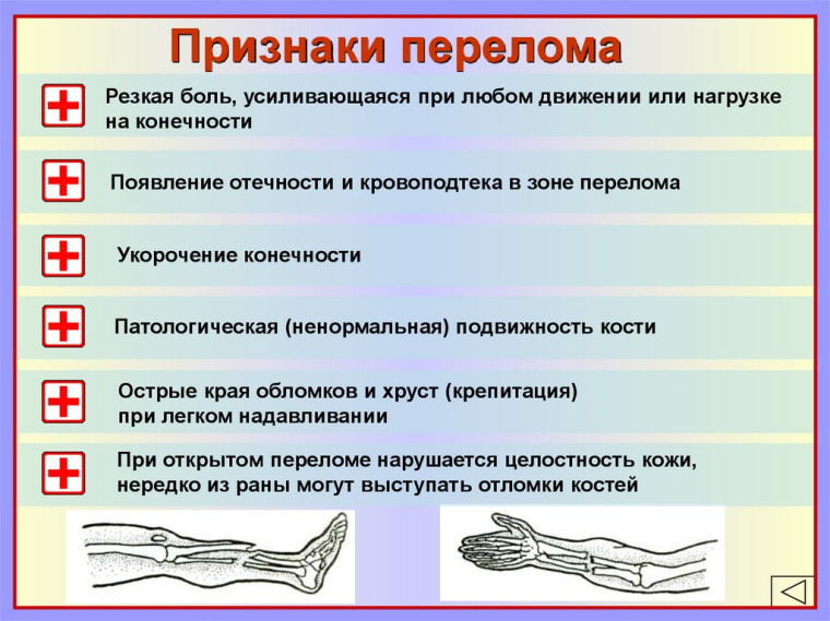 Видеоролики. Травмы конечностей..